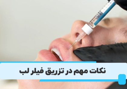 نکات مهم تزریق ژل لب