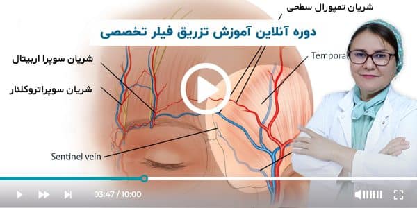 آموزش تزریق فیلر پیشرفته