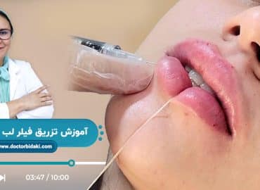 آموزش تزریق ژل لب