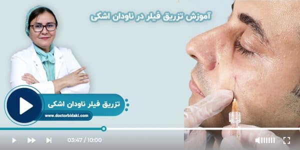 آموزش تزریق فیلر زیر چشم