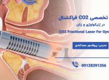 آموزش لیزر co2 فراکشنال واژینال