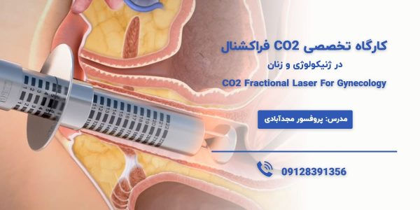 آموزش لیزر co2 فراکشنال واژینال