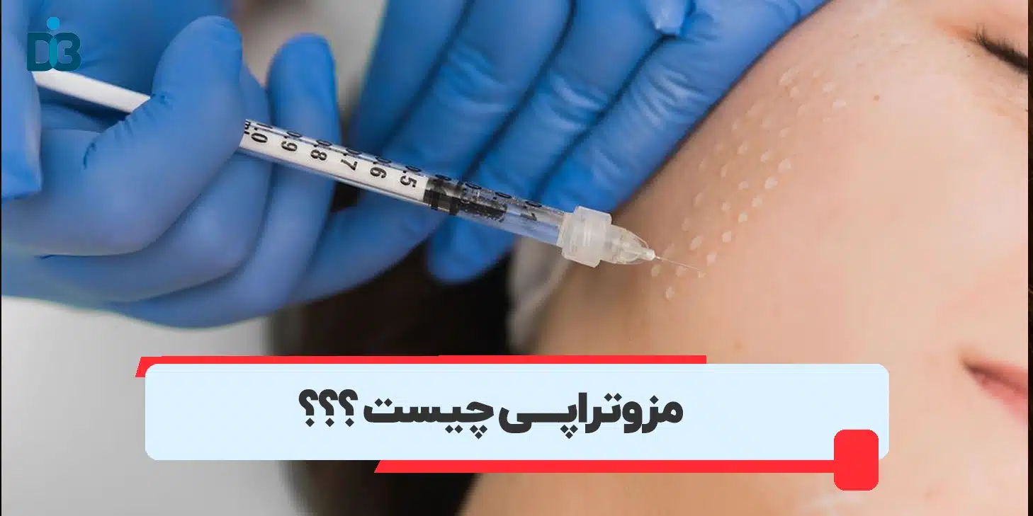 مزوتراپی چیست؟