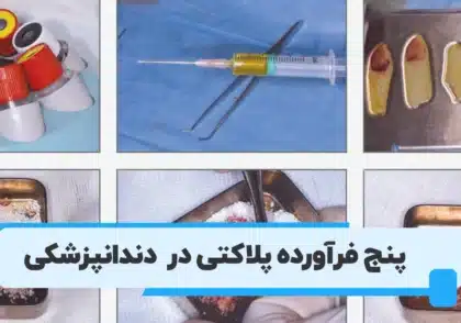 فرآورده پلاکتی در درمان های دندانپزشکی