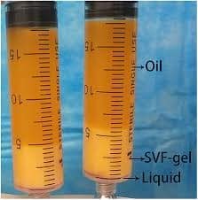 آموزش SVF Gel