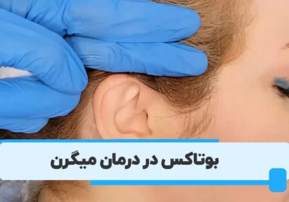 بوتاکس میگرن