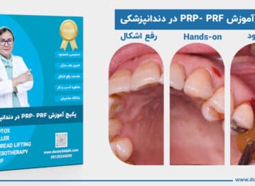 آموزش پی آرپی ، پی آراف در دندانپزشکی