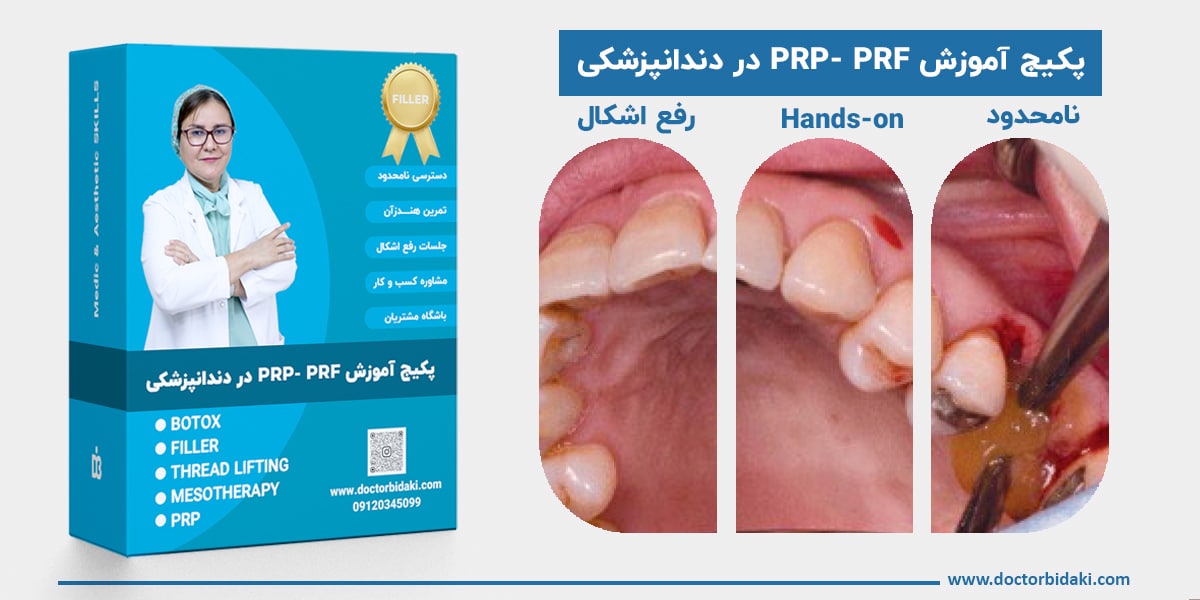 آموزش پی آرپی ، پی آراف در دندانپزشکی