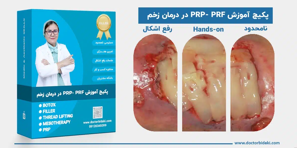 آموزش پی آرپی و پی آراف در درمان زخم