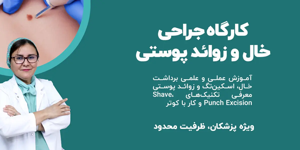 آموزش جراحی خال